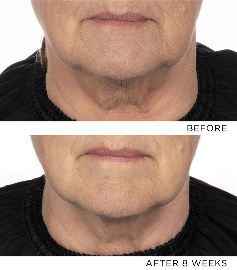 The Absolute Peptide8 Night Serum